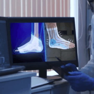 Calcetines De Neuro Compresión Obtén Alivio Instantáneo De Pies Hinchados Y Adoloridos